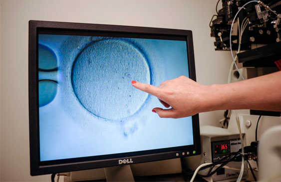 Fertilización In vitro,Costa Rica,CCSS,Fecundación in vitro